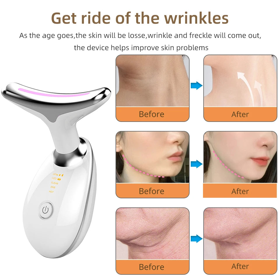 Smart V-Face Lifting Device